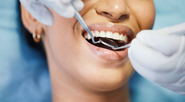 Best Emergency Dental Care for Broken or Chipped Teeth in Woonsocket, RI