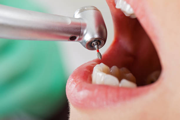 Best Emergency Treatment for Dental Infections or Abscesses in Woonsocket, RI